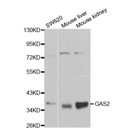 Western blot - GAS2 Antibody from Signalway Antibody (32198) - Antibodies.com