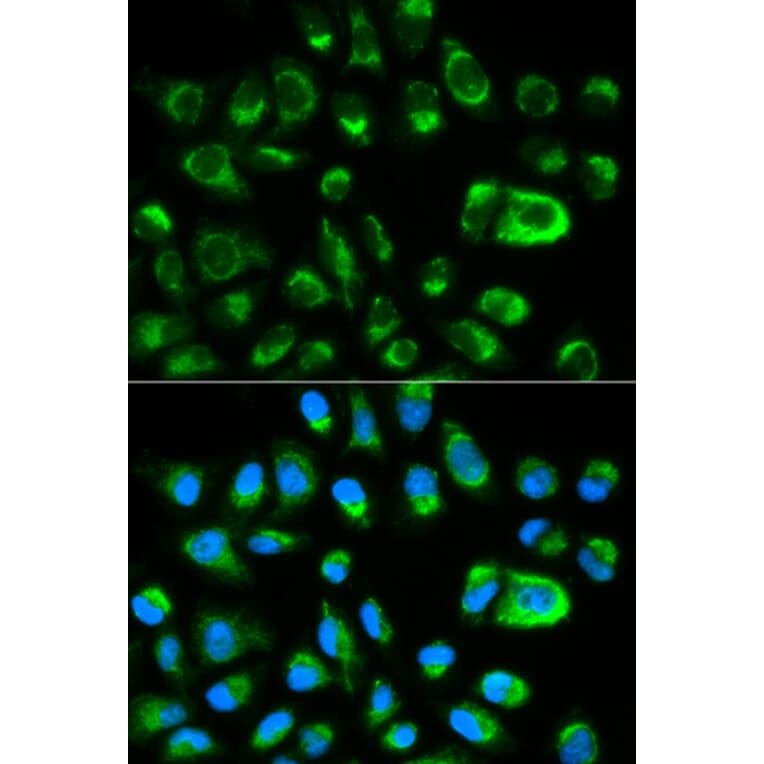 Immunofluorescence - GAS2 Antibody from Signalway Antibody (32198) - Antibodies.com