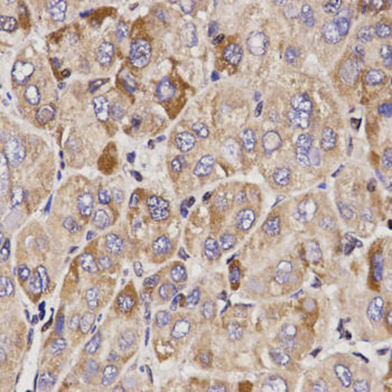 Immunohistochemistry - GAS2 Antibody from Signalway Antibody (32198) - Antibodies.com