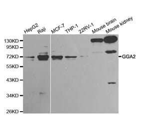 Western blot - GGA2 Antibody from Signalway Antibody (32212) - Antibodies.com