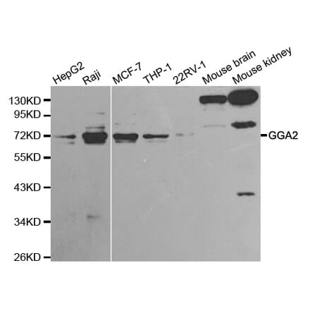 Western blot - GGA2 Antibody from Signalway Antibody (32212) - Antibodies.com