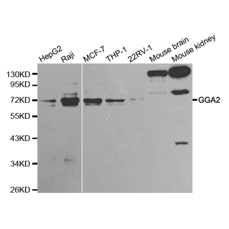 Western blot - GGA2 Antibody from Signalway Antibody (32212) - Antibodies.com