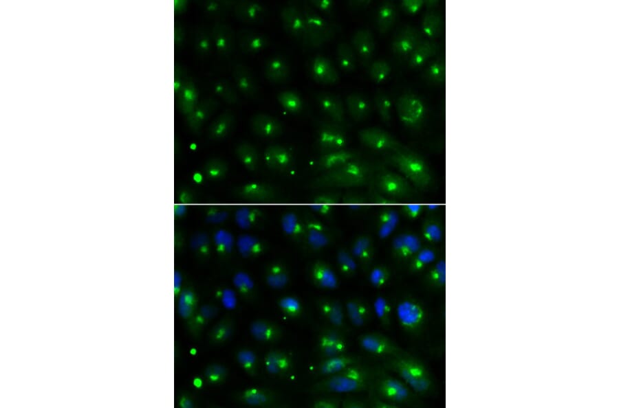 Immunofluorescence - GGA2 Antibody from Signalway Antibody (32212) - Antibodies.com