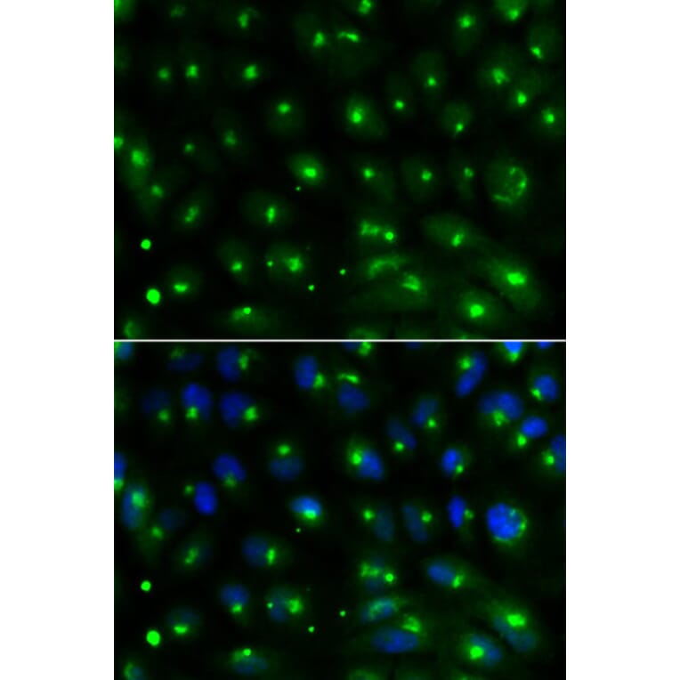 Immunofluorescence - GGA2 Antibody from Signalway Antibody (32212) - Antibodies.com