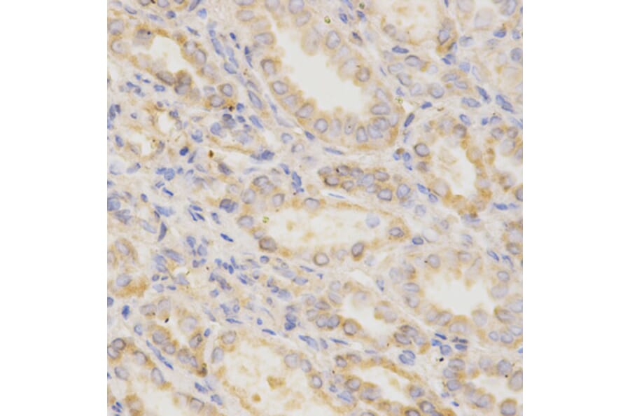 Immunohistochemistry - GGA2 Antibody from Signalway Antibody (32212) - Antibodies.com
