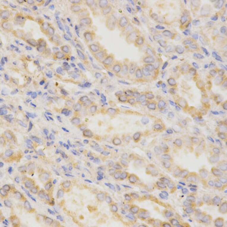 Immunohistochemistry - GGA2 Antibody from Signalway Antibody (32212) - Antibodies.com