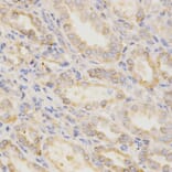 Immunohistochemistry - GGA2 Antibody from Signalway Antibody (32212) - Antibodies.com