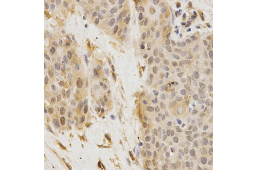 Immunohistochemistry - GGA2 Antibody from Signalway Antibody (32212) - Antibodies.com