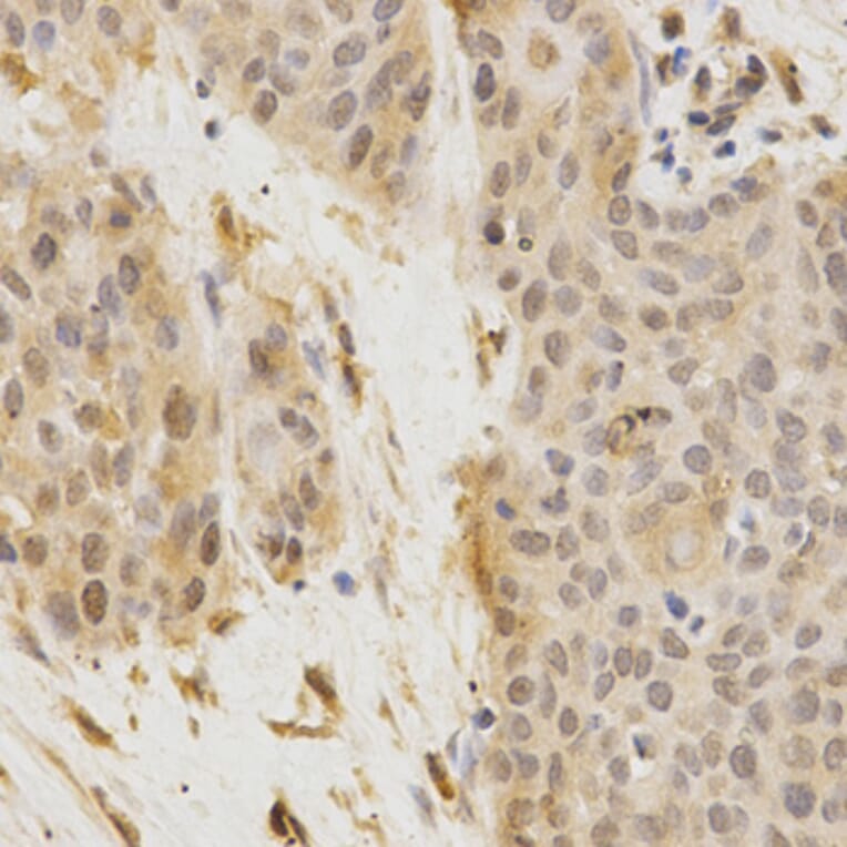 Immunohistochemistry - GGA2 Antibody from Signalway Antibody (32212) - Antibodies.com