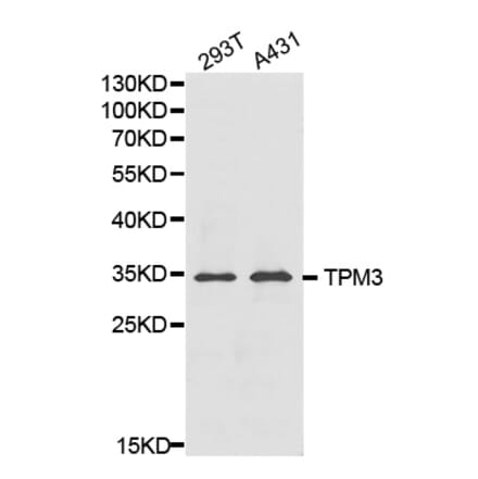 Western blot - TPM3 Antibody from Signalway Antibody (32227) - Antibodies.com