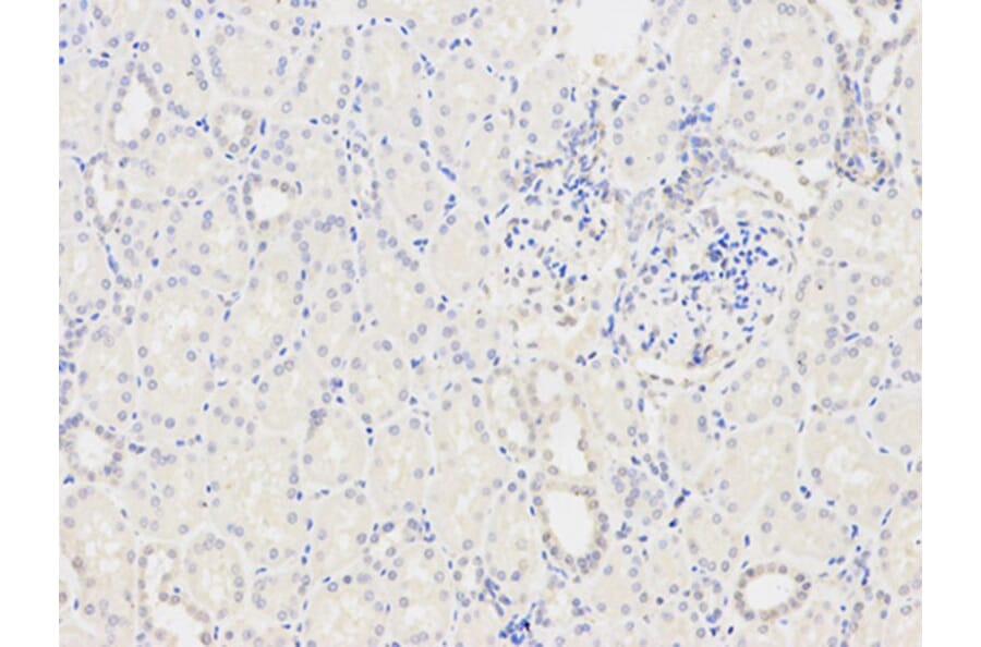 Immunohistochemistry - TPM3 Antibody from Signalway Antibody (32227) - Antibodies.com