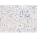 Immunohistochemistry - TPM3 Antibody from Signalway Antibody (32227) - Antibodies.com