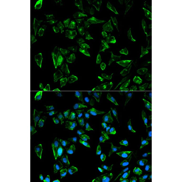 Immunofluorescence - TPM3 Antibody from Signalway Antibody (32227) - Antibodies.com