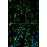 Immunofluorescence - TPM3 Antibody from Signalway Antibody (32227) - Antibodies.com