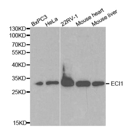Western blot - ECI1 Antibody from Signalway Antibody (32230) - Antibodies.com