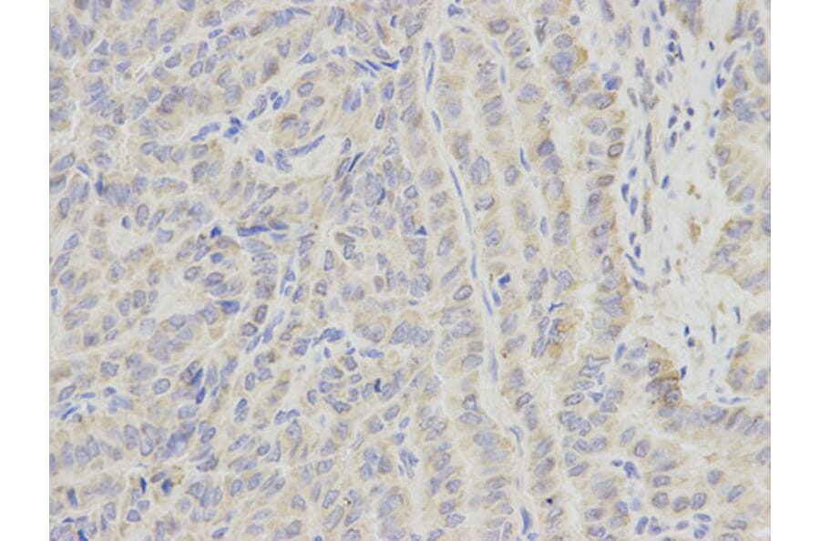 Immunohistochemistry - ECI1 Antibody from Signalway Antibody (32230) - Antibodies.com
