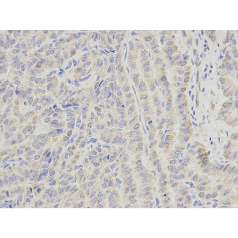 Immunohistochemistry - ECI1 Antibody from Signalway Antibody (32230) - Antibodies.com