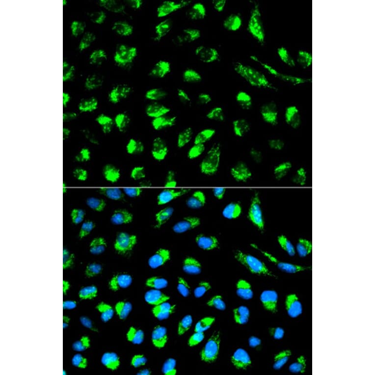 Immunofluorescence - ECI1 Antibody from Signalway Antibody (32230) - Antibodies.com