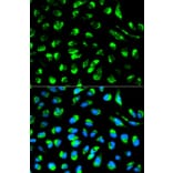Immunofluorescence - ECI1 Antibody from Signalway Antibody (32230) - Antibodies.com