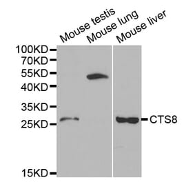 Western blot - CST8 Antibody from Signalway Antibody (32239) - Antibodies.com