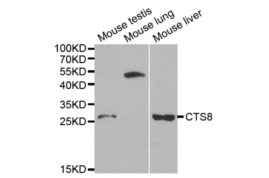 Western blot - CST8 Antibody from Signalway Antibody (32239) - Antibodies.com