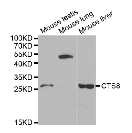 Western blot - CST8 Antibody from Signalway Antibody (32239) - Antibodies.com