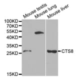 Western blot - CST8 Antibody from Signalway Antibody (32239) - Antibodies.com