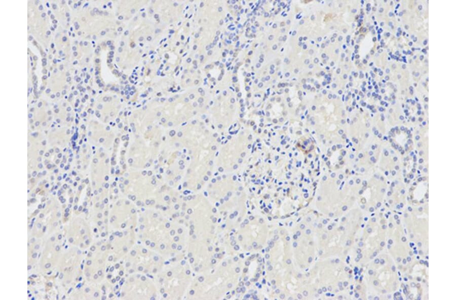 Immunohistochemistry - CST8 Antibody from Signalway Antibody (32239) - Antibodies.com