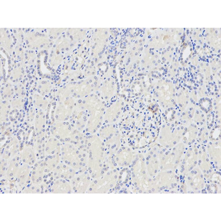 Immunohistochemistry - CST8 Antibody from Signalway Antibody (32239) - Antibodies.com
