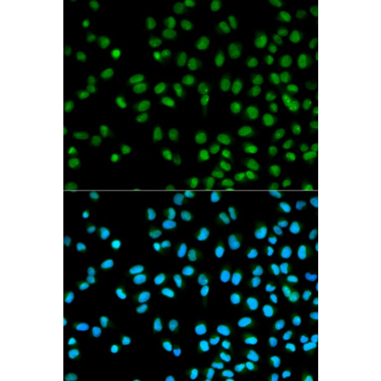 Immunofluorescence - CST8 Antibody from Signalway Antibody (32239) - Antibodies.com