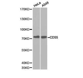 Western blot - CD55 Antibody from Signalway Antibody (32243) - Antibodies.com
