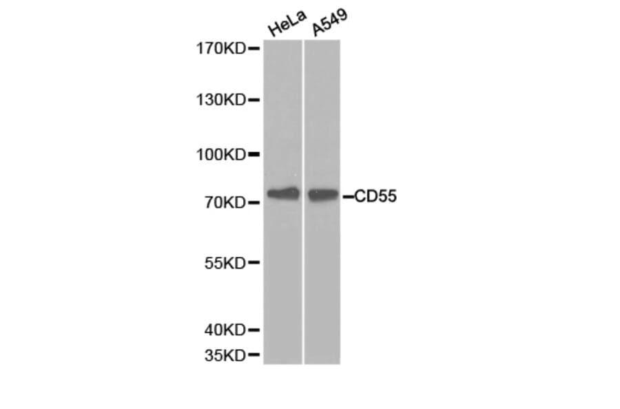 Western blot - CD55 Antibody from Signalway Antibody (32243) - Antibodies.com
