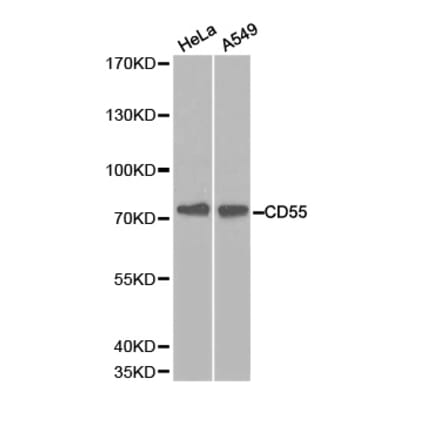 Western blot - CD55 Antibody from Signalway Antibody (32243) - Antibodies.com