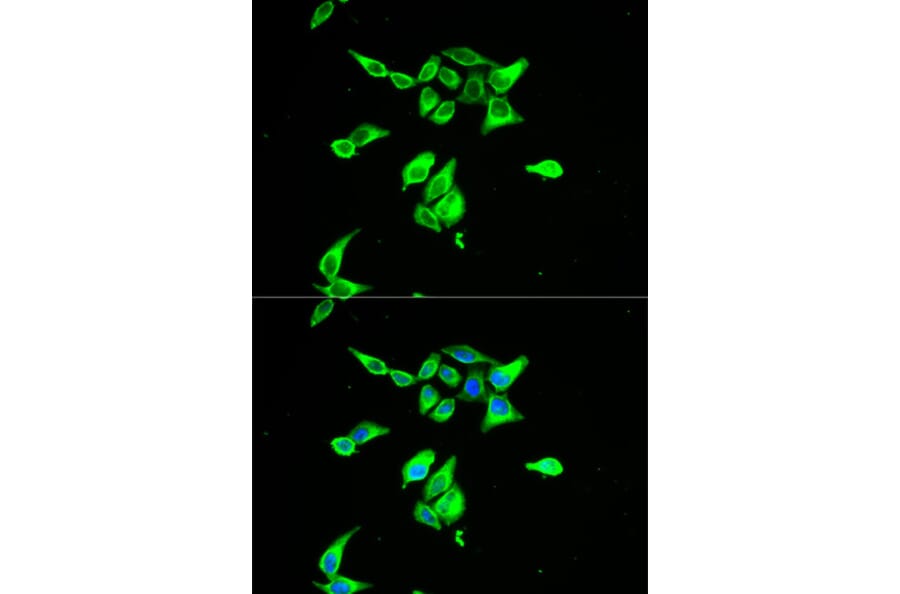 Immunofluorescence - CD55 Antibody from Signalway Antibody (32243) - Antibodies.com
