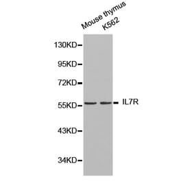 Western blot - IL7R Antibody from Signalway Antibody (32245) - Antibodies.com
