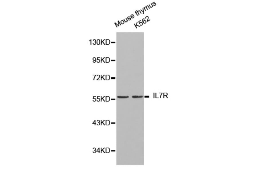 Western blot - IL7R Antibody from Signalway Antibody (32245) - Antibodies.com