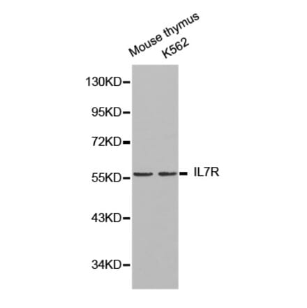 Western blot - IL7R Antibody from Signalway Antibody (32245) - Antibodies.com