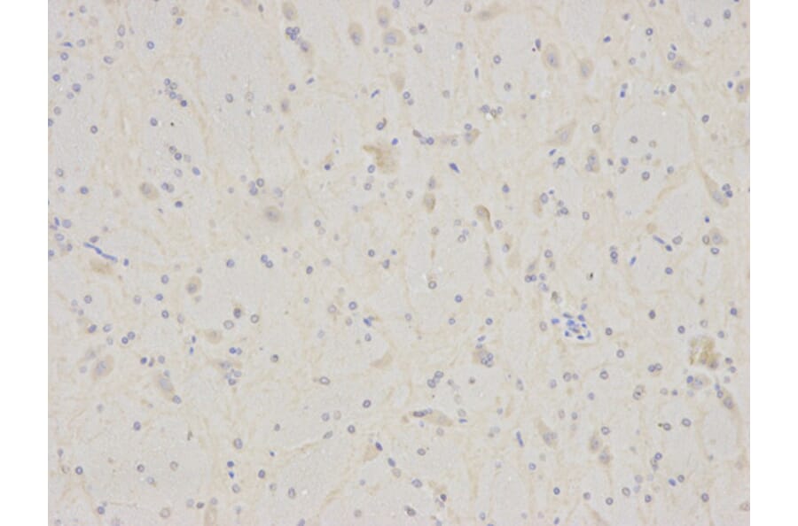 Immunohistochemistry - IL7R Antibody from Signalway Antibody (32245) - Antibodies.com