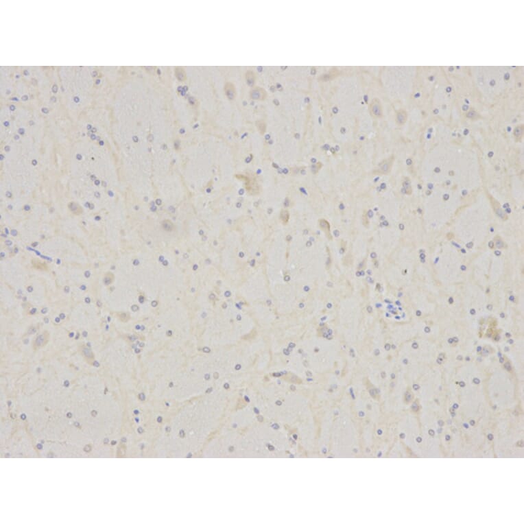Immunohistochemistry - IL7R Antibody from Signalway Antibody (32245) - Antibodies.com