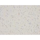 Immunohistochemistry - IL7R Antibody from Signalway Antibody (32245) - Antibodies.com