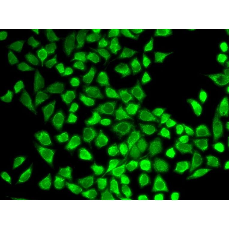 Immunofluorescence - IL7R Antibody from Signalway Antibody (32245) - Antibodies.com