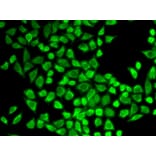 Immunofluorescence - IL7R Antibody from Signalway Antibody (32245) - Antibodies.com