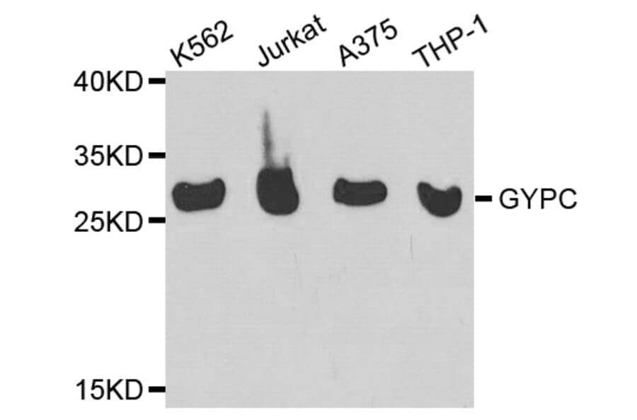 Western blot - GYPC Antibody from Signalway Antibody (32247) - Antibodies.com