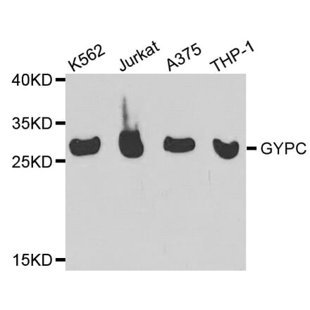 Western blot - GYPC Antibody from Signalway Antibody (32247) - Antibodies.com