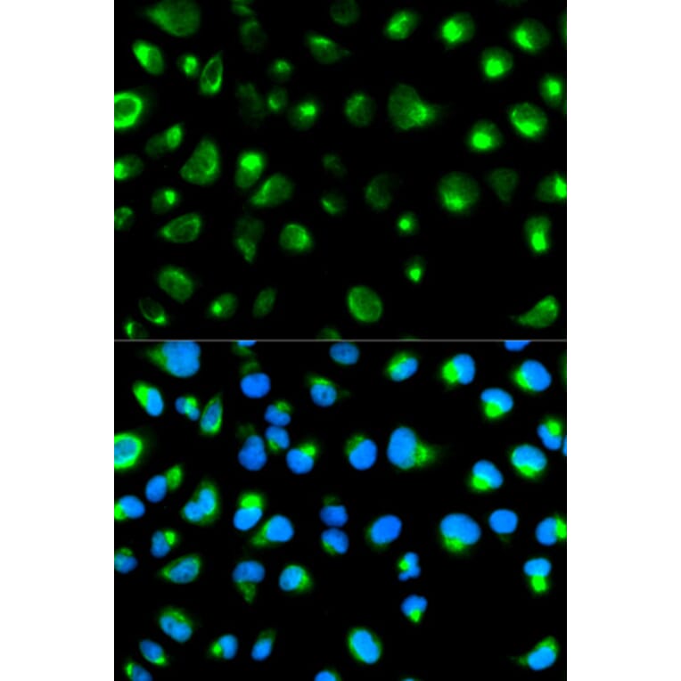 Immunofluorescence - GYPC Antibody from Signalway Antibody (32247) - Antibodies.com