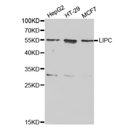Western blot - LIPC Antibody from Signalway Antibody (32277) - Antibodies.com