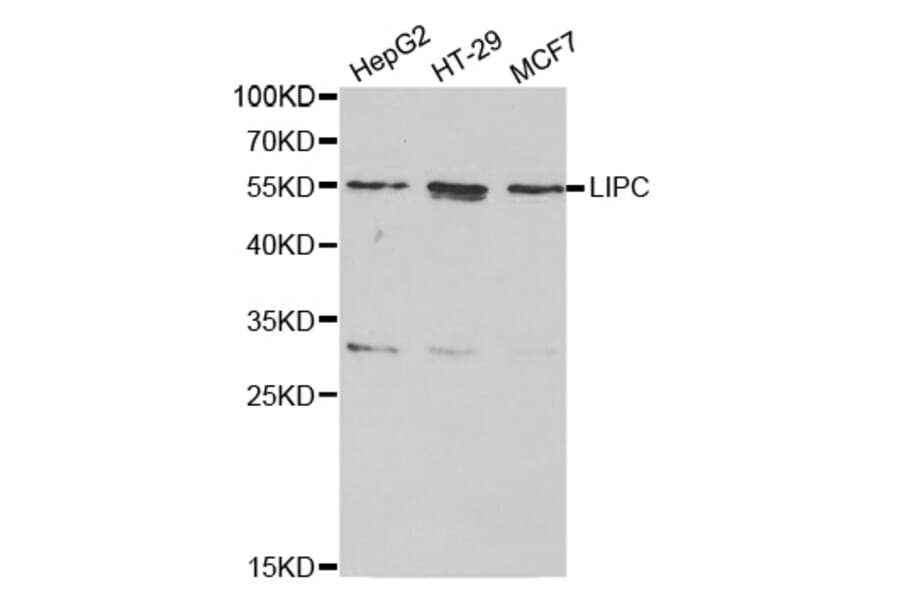 Western blot - LIPC Antibody from Signalway Antibody (32277) - Antibodies.com