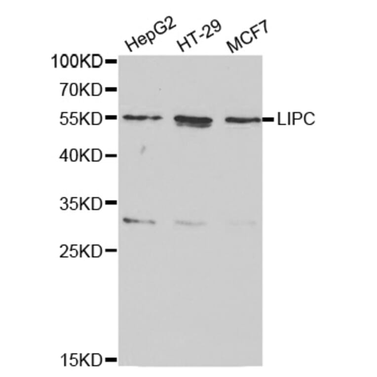 Western blot - LIPC Antibody from Signalway Antibody (32277) - Antibodies.com