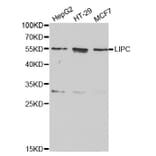 Western blot - LIPC Antibody from Signalway Antibody (32277) - Antibodies.com