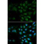 Immunofluorescence - LIPC Antibody from Signalway Antibody (32277) - Antibodies.com